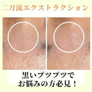 ピーリング専門店 Belluteのエステ・リラクイメージ