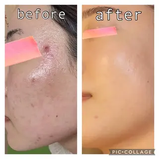 ニキビ改善専門店 d'Albaのエステ・リラクイメージ