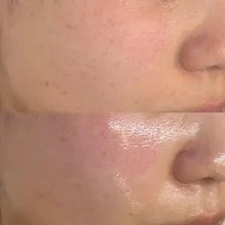 韓国🇰🇷価格 サロン_Nbibiのエステ・リラクイメージ