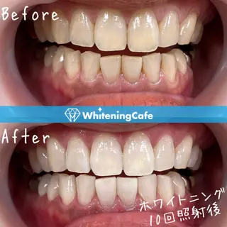 ホワイトニングカフェ徳島沖浜店所属・ホワイトニングカフェ 徳島沖浜店のエステ・リラクイメージ