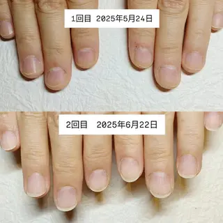 ネイル 深爪矯正/爪育成ケア manie nailのネイルデザイン