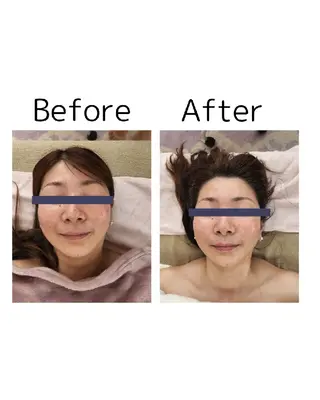    Plumeのエステ・リラクイメージ