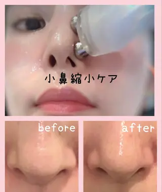 Beauty salon ハピー所属・大人女性のための 肌管理サロン　ハピーのエステ・リラクイメージ