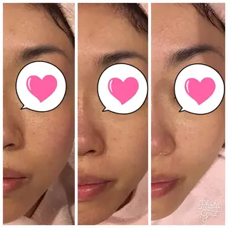 Une rencontre (ユヌ・ランコント)所属・つや肌専門店ユヌ・ ランコント中井のエステ・リラクイメージ