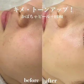 韓国肌管理&小顔 ＩＲＯＨＡのエステ・リラクイメージ