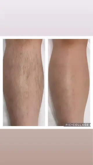 MARI シュガーリストのエステ・リラクイメージ