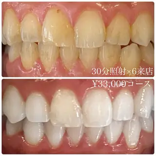 メンズ ホワイトニングルーム　川崎店所属・ホワイトニング ルーム　川崎店のその他イメージ