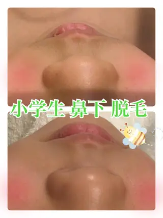 【リベルハーブピーリング認定店】敏感肌・美白脱毛専門店Dione立川店所属・Dione 立川店のエステ・リラクイメージ