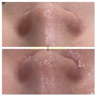 ビューティー ミロワールのエステ・リラクイメージ