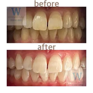 ホワイトニング ショップ本八幡店のエステ・リラクイメージ