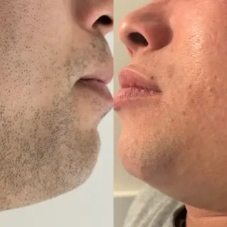 セルフエステエンリケ明石大久保店所属・夕希 毛穴と脱毛特化サロンのエステ・リラクイメージ