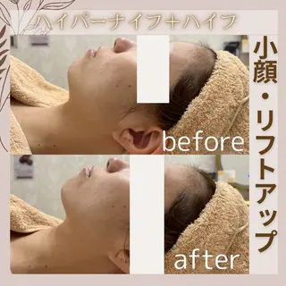 aimer 佐々木のエステ・リラクイメージ