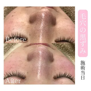 肌質改善サロン BestBelleのエステ・リラクイメージ