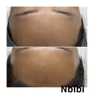 韓国🇰🇷価格 サロン_Nbibiのエステ・リラクイメージ