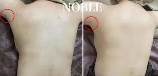 NOBLE 新宿南口店のエステ・リラクイメージ