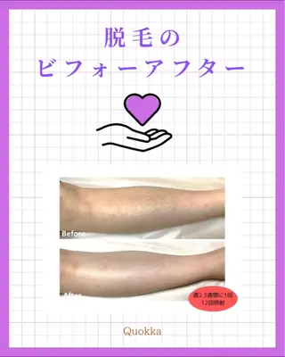 Quokka ✴︎ あま市甚目寺のエステ・リラクイメージ