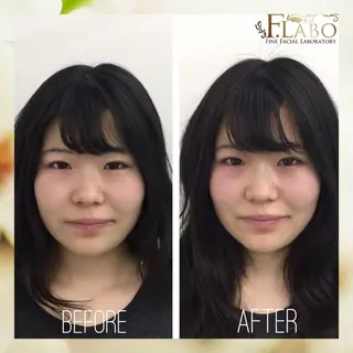 小顔&ダイエットジム エステ担当REIKOのその他イメージ