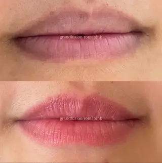 Lumiere despoir所属・Lumiere despoirのエステ・リラクイメージ