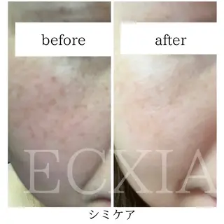 ECXIA 【エクシア】のエステ・リラクイメージ