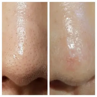 ホリスティックラボ EnnYuiのエステ・リラクイメージ