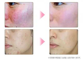 moe所属・moe beautyのエステ・リラクイメージ