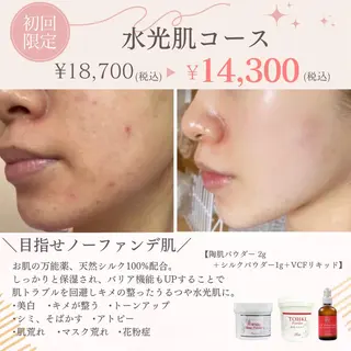 hm NATURESKINのエステ・リラクイメージ