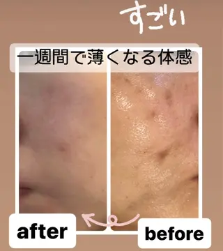 🅖🅤🅩🅔🅛 salonのエステ・リラクイメージ