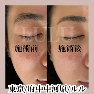 アイブロウ LULU所属・LULU ルルのエステ・リラクイメージ