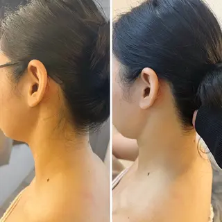 うなじ脱毛/美肌脱毛 LABELのエステ・リラクイメージ