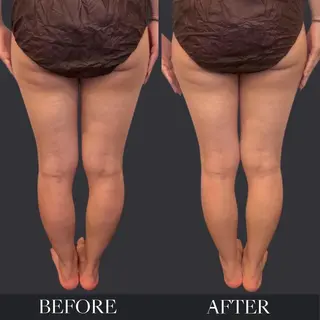 NaturePlus Masamiのエステ・リラクイメージ