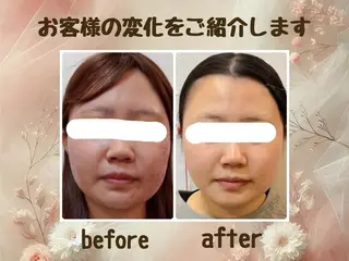 小顔矯正＆美肌サロン ブプラ大元駅前店のエステ・リラクイメージ