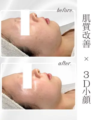 Liam《美肌管理/ 3D小顔/脂肪ケア》のエステ・リラクイメージ