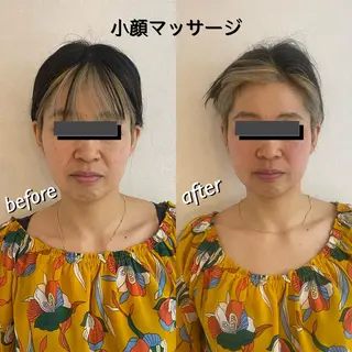 うなじ脱毛/美肌脱毛 LABELのエステ・リラクイメージ