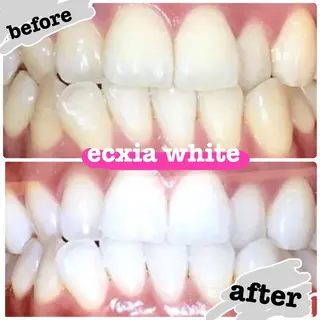 エクシアホワイトニング日本橋所属・エクシア ホワイトニング日本橋のその他イメージ