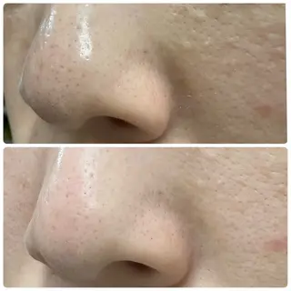 M.riche エムリシェのエステ・リラクイメージ