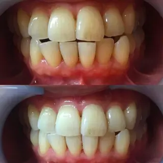 ミディアム カラー パーマ ヘアアレンジ ネイル マツエク・マツパ アイブロウ LBSホワイトニング 🌐梅田店公式のその他イメージ