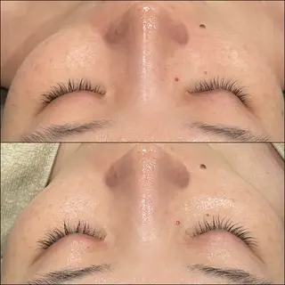 LiZA エステティックサロンのエステ・リラクイメージ