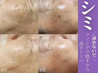 リラクビューティーCamellia(カメリア)所属・リラクビューティー Camelliaのエステ・リラクイメージ