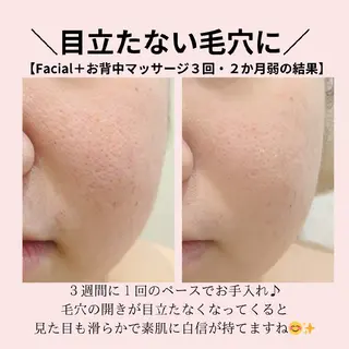 PRETTIEST SHINE所属・フェイシャル/ボディ /ブライダル山田浩子のエステ・リラクイメージ