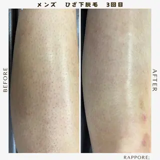 メンズ Rappore; 心斎橋 みずきのエステ・リラクイメージ