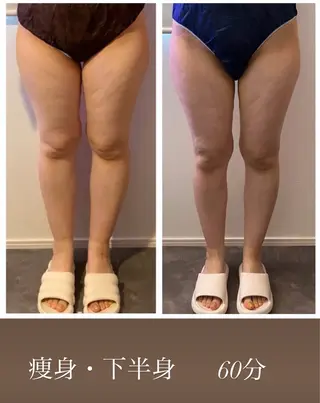 本気で痩せたい方へ 痩身専門サロンのエステ・リラクイメージ