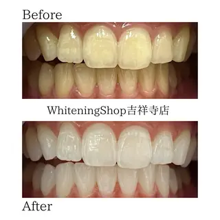 ホワイトニング ショップ吉祥寺店のエステ・リラクイメージ