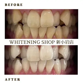 メンズ ホワイトニング ショップ新小岩店のその他イメージ