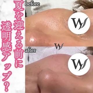 メンズ ホワイトワックス名古屋金山店所属・ホワイトワックス 金山店のエステ・リラクイメージ