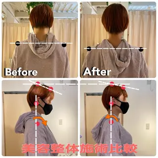 鍼灸整骨院Refine所属・鍼灸 Refineのその他イメージ