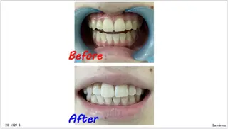 セルフホワイトニングサロン　ラヴィアン所属・ホワイトニングサロン La vie enのその他イメージ