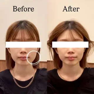 Hari Lounge恵比寿所属・chika🦋 ハリラウンジ恵比寿のエステ・リラクイメージ