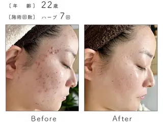 SALON BioBioのエステ・リラクイメージ