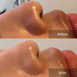 肌育ピーリング 🫧megumiのエステ・リラクイメージ