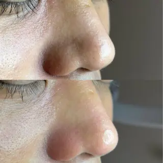 メンズ 毛穴ケア・ヘッドスパサロンSHINY(シャイニー)所属・毛穴ケア・ヘッドスパ サロンSHINYのエステ・リラクイメージ